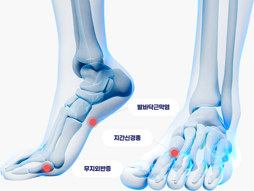현장